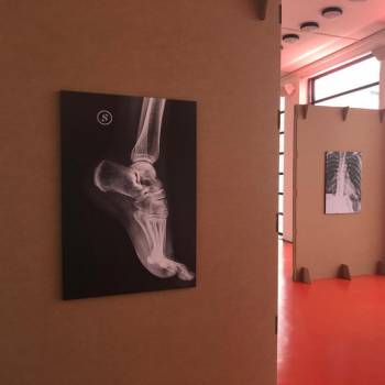 Foto: Violenza: in mostra le ossa rotte (Roma, WeGil)
